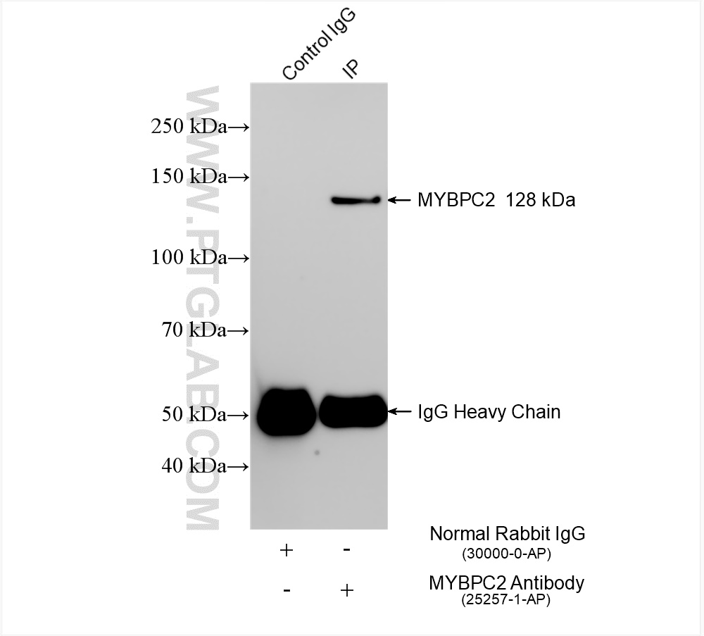 Immunoprecipitation (IP) experiment of mouse skeletal muscle tissue using MYBPC2 Polyclonal antibody (25257-1-AP)