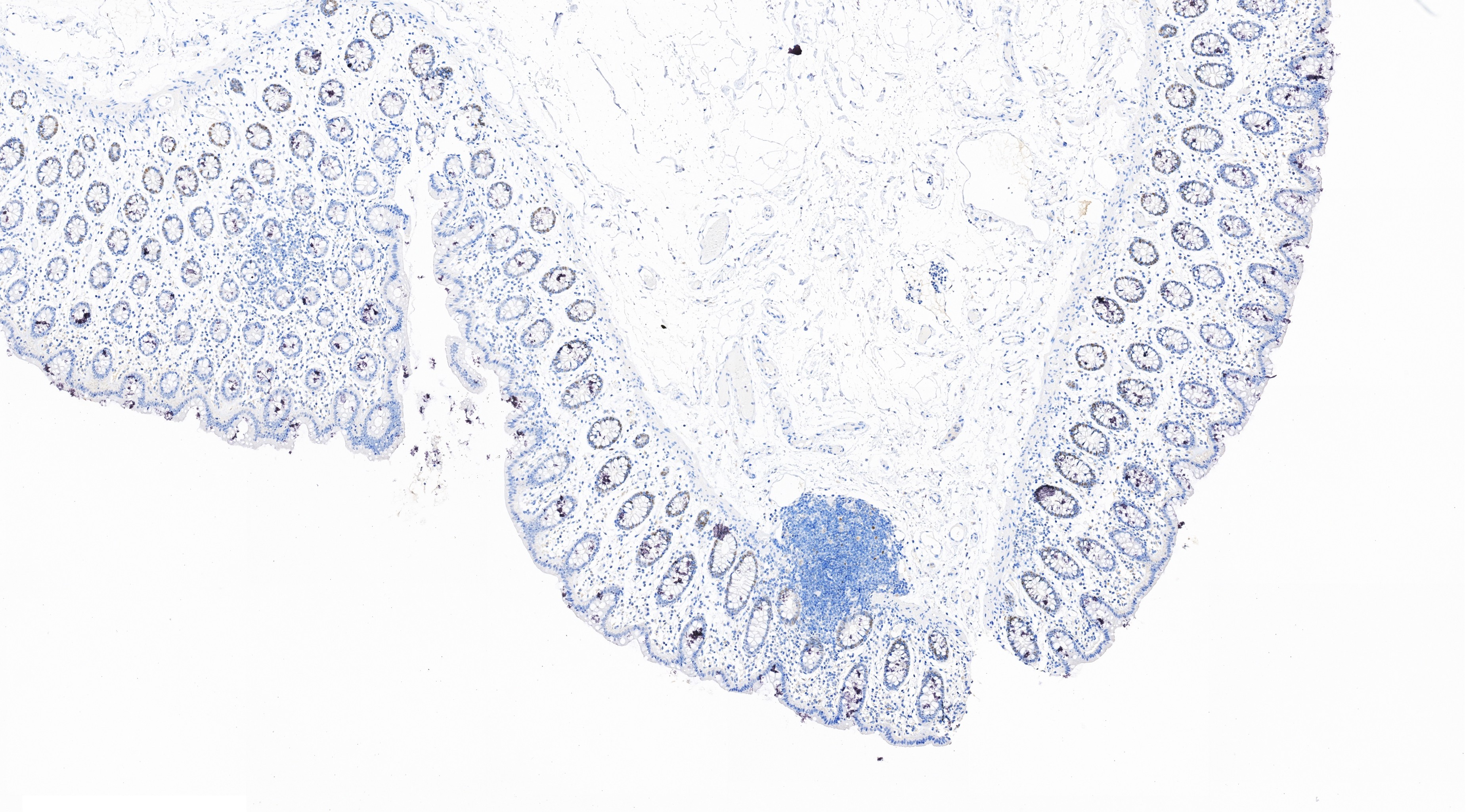 Immunohistochemistry (IHC) staining of human colon tissue using c-MYC Recombinant monoclonal antibody (80845-1-RR)