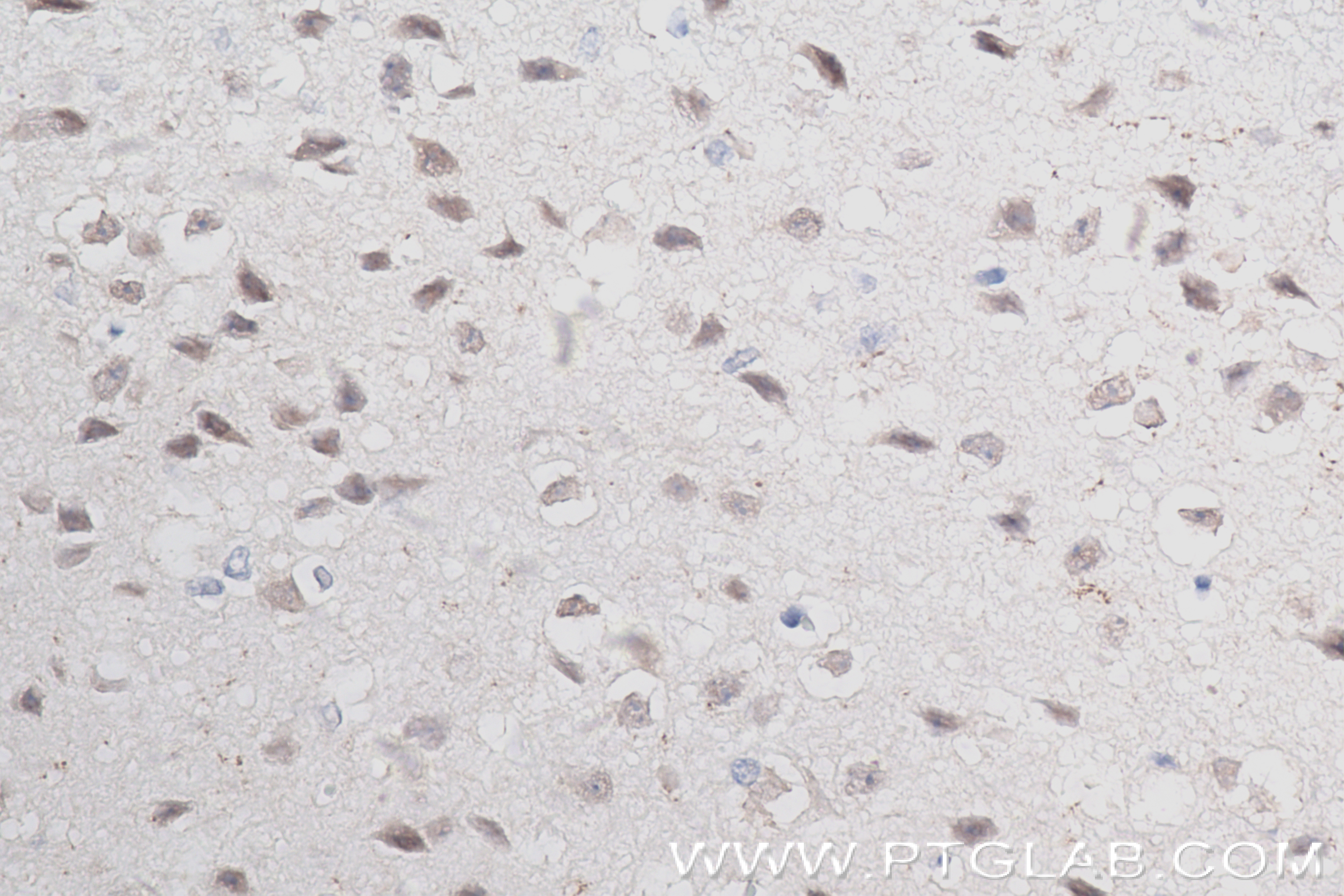 Immunohistochemistry (IHC) staining of mouse brain tissue using c-MYC Recombinant antibody (80845-1-RR)