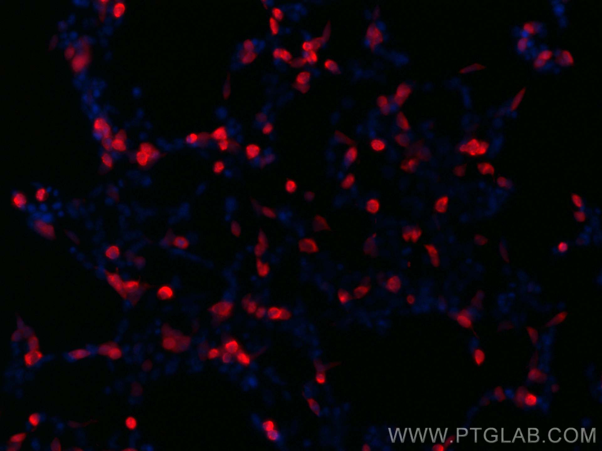 Immunofluorescence (IF) / fluorescent staining of Transfected HEK-293 cells using CoraLite® Plus 594-conjugated MYC tag Monoclonal a (CL594-60003)