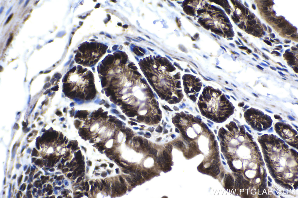 Immunohistochemistry (IHC) staining of mouse colon tissue using MYCBP Polyclonal antibody (12022-1-AP)