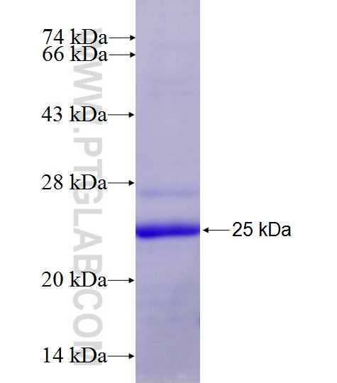 MYCBP2 fusion protein Ag27162 SDS-PAGE