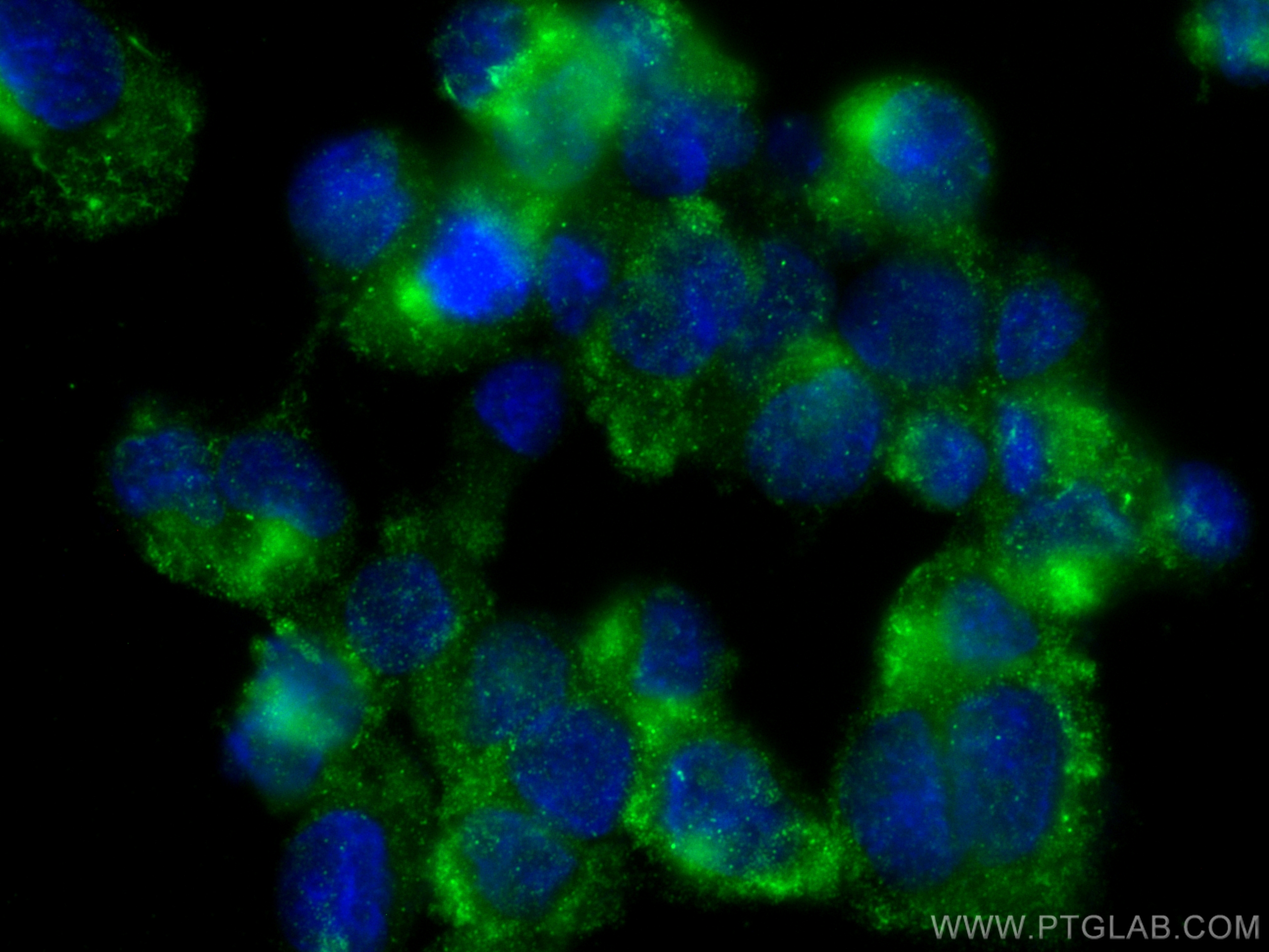 Immunofluorescence (IF) / fluorescent staining of HUVEC cells using MYCBPAP Polyclonal antibody (12763-1-AP)