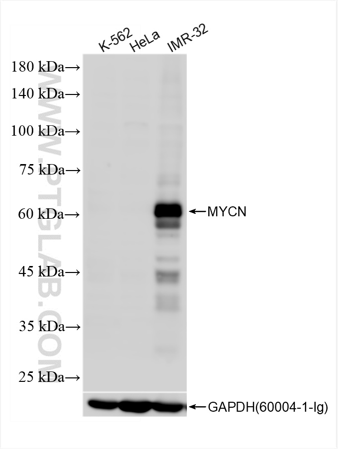 Western Blot (WB) analysis of various lysates using MYCN Recombinant antibody (84886-3-RR)