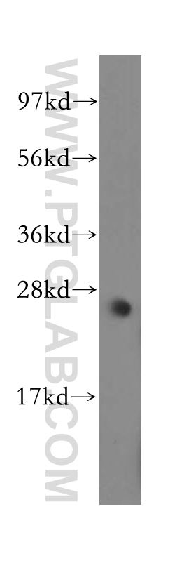 Western Blot (WB) analysis of mouse skeletal muscle tissue using MYF6 Polyclonal antibody (11754-1-AP)