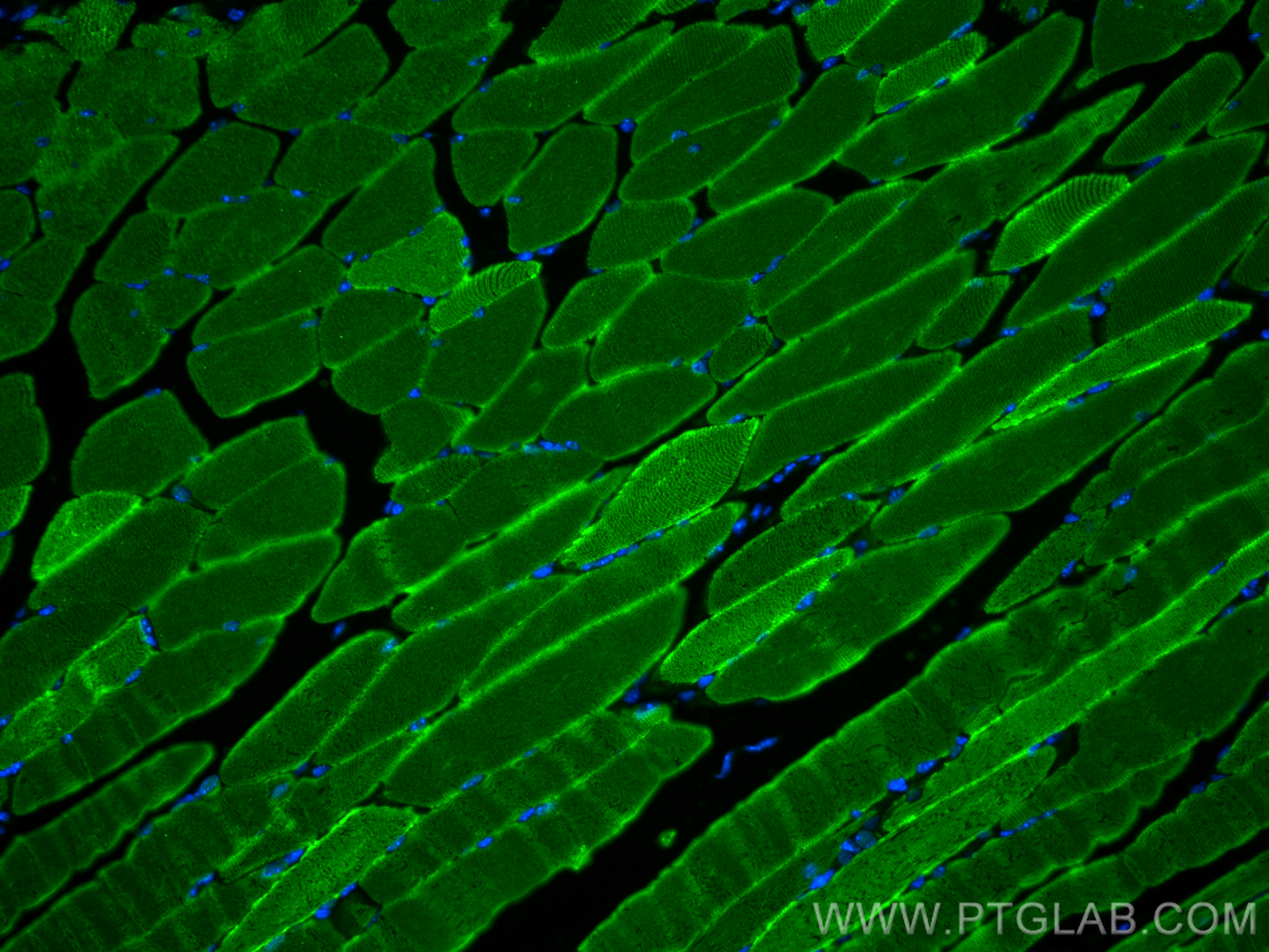 Immunofluorescence (IF) / fluorescent staining of mouse skeletal muscle tissue using MYH1 (N-terminal) Polyclonal antibody (25182-1-AP)