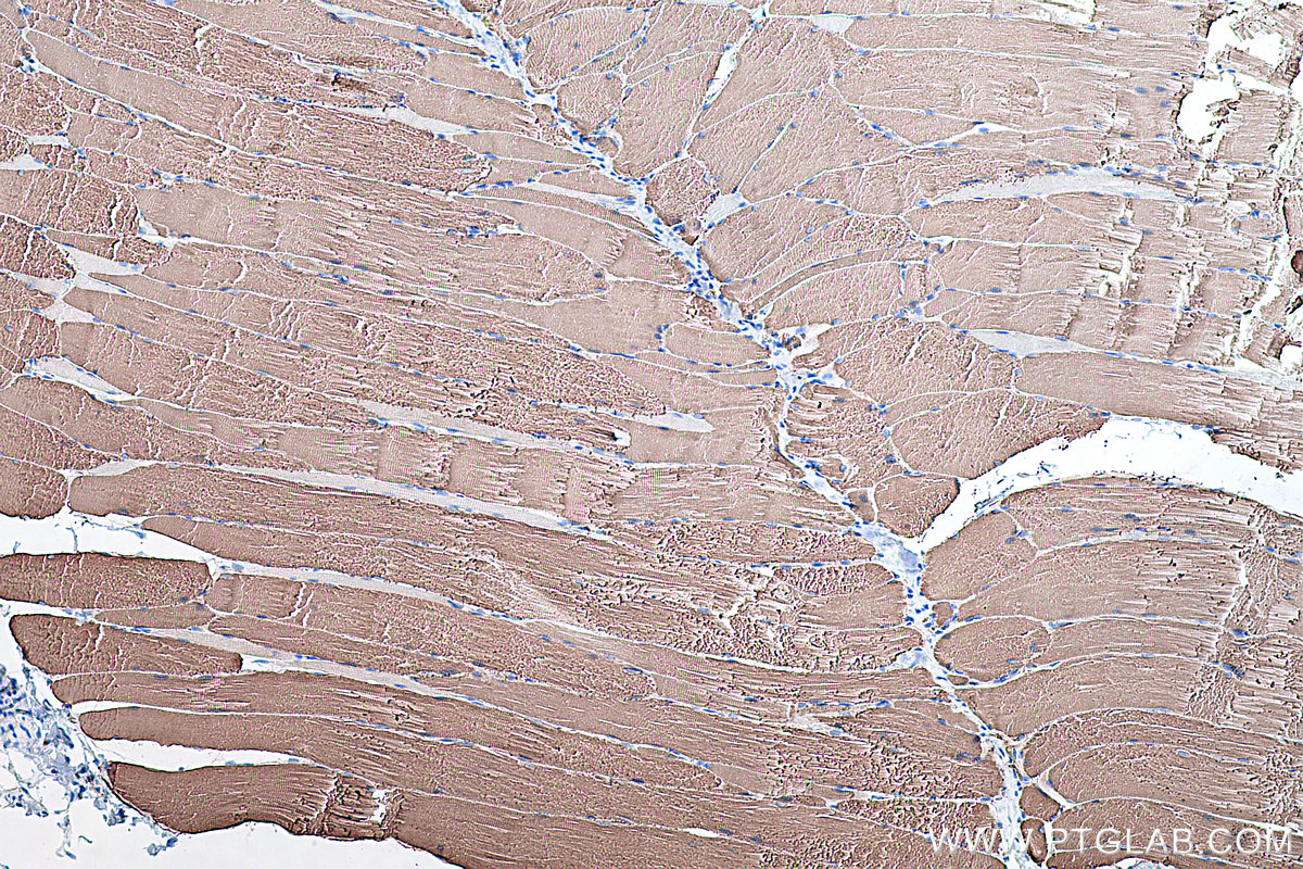 Immunohistochemistry (IHC) staining of rat skeletal muscle tissue using MYH1 Monoclonal antibody (67299-1-Ig)