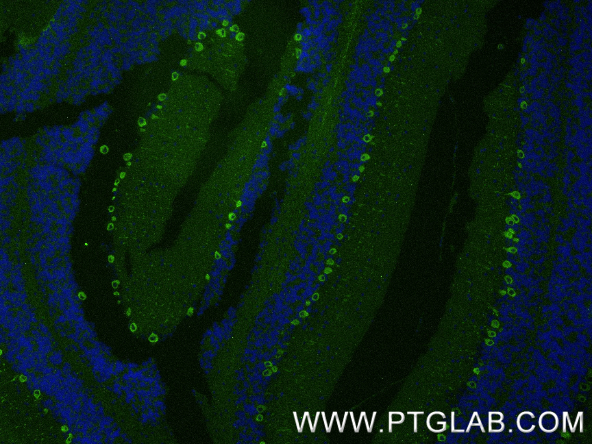 Immunofluorescence (IF) / fluorescent staining of mouse cerebellum tissue using MYH10 Recombinant antibody (86157-3-RR)