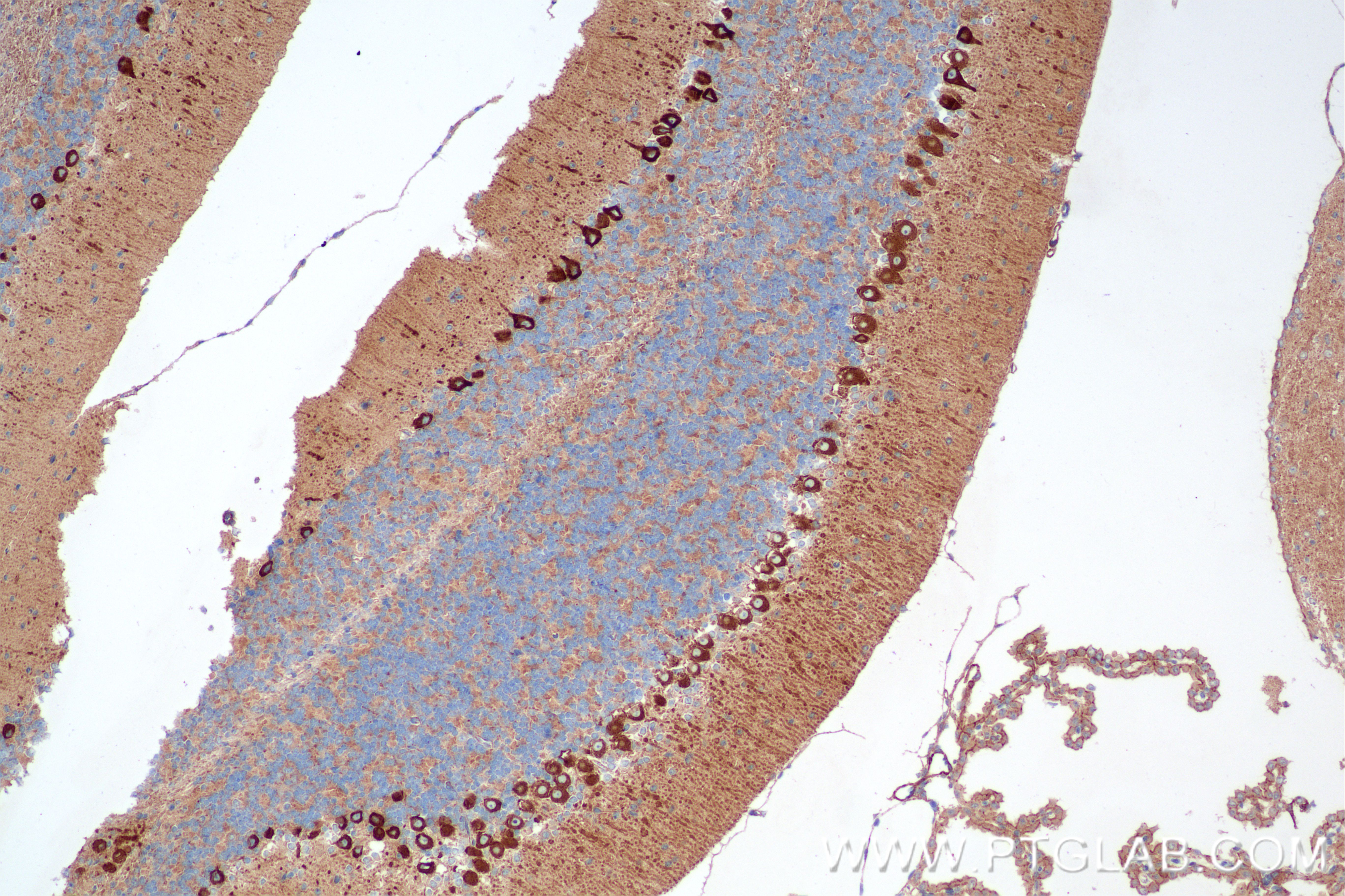 Immunohistochemistry (IHC) staining of mouse cerebellum tissue using MYH10 Recombinant antibody (86157-3-RR)
