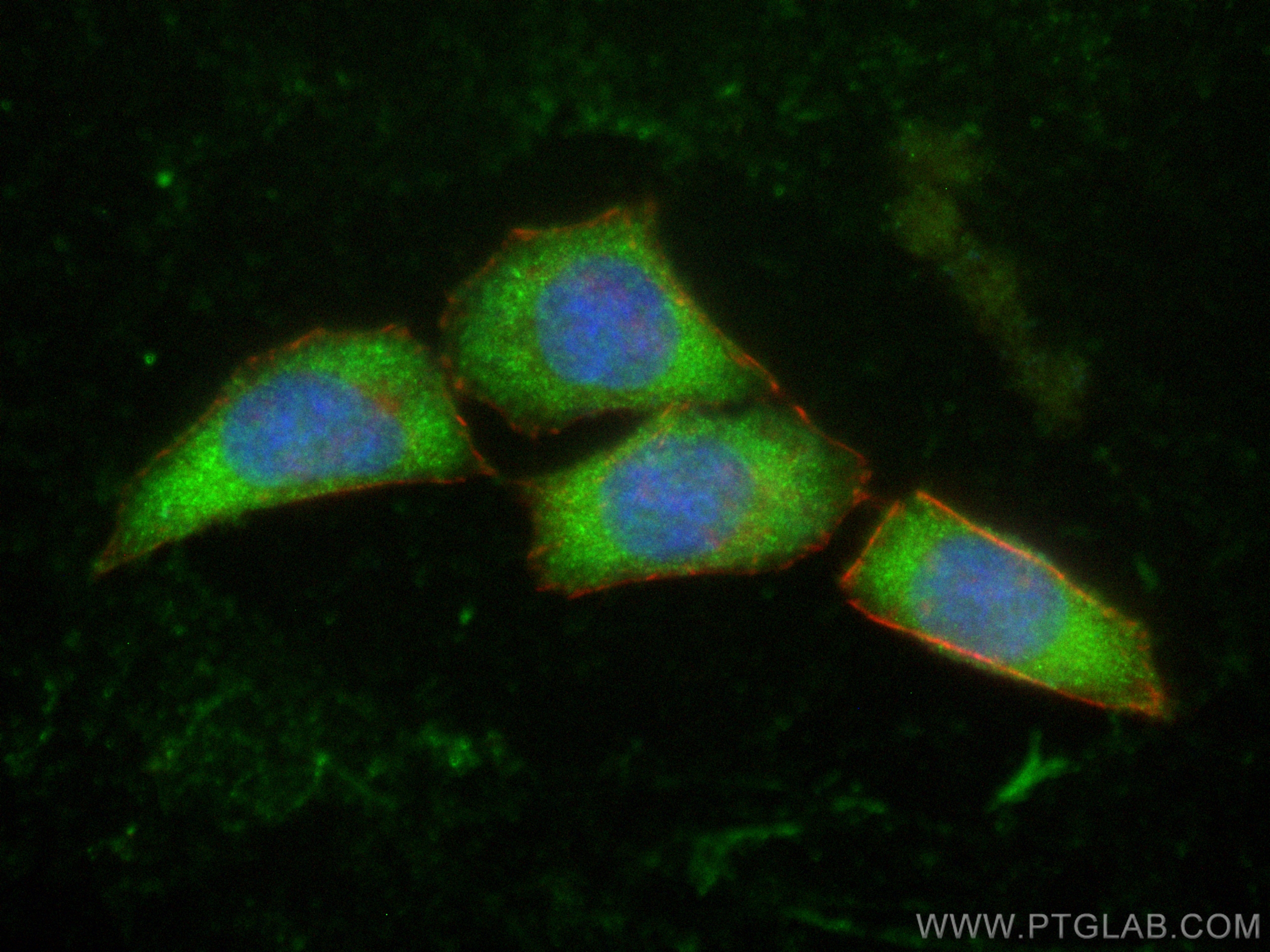 Immunofluorescence (IF) / fluorescent staining of HepG2 cells using CoraLite® Plus 488-conjugated MYH10 Polyclonal ant (CL488-21403)