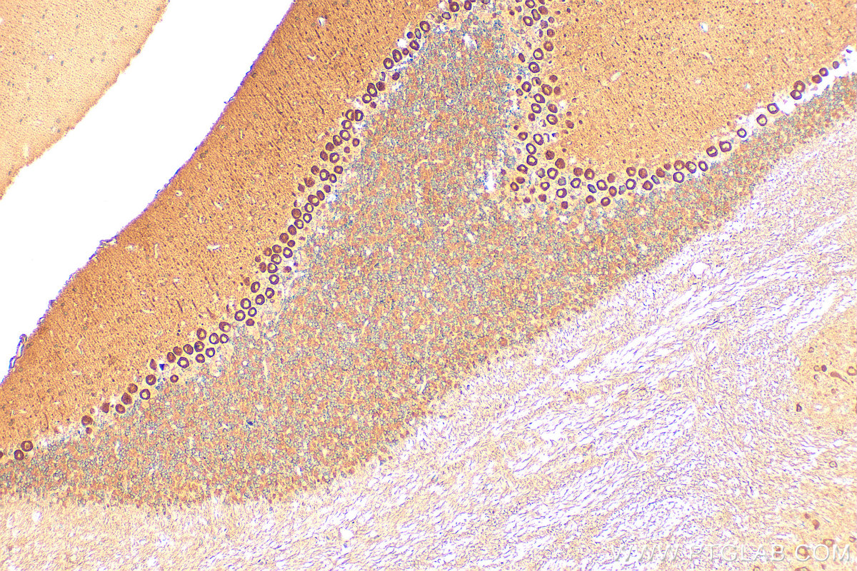 Immunohistochemistry (IHC) staining of mouse cerebellum tissue using MYH10-Specific Polyclonal antibody (19673-1-AP)