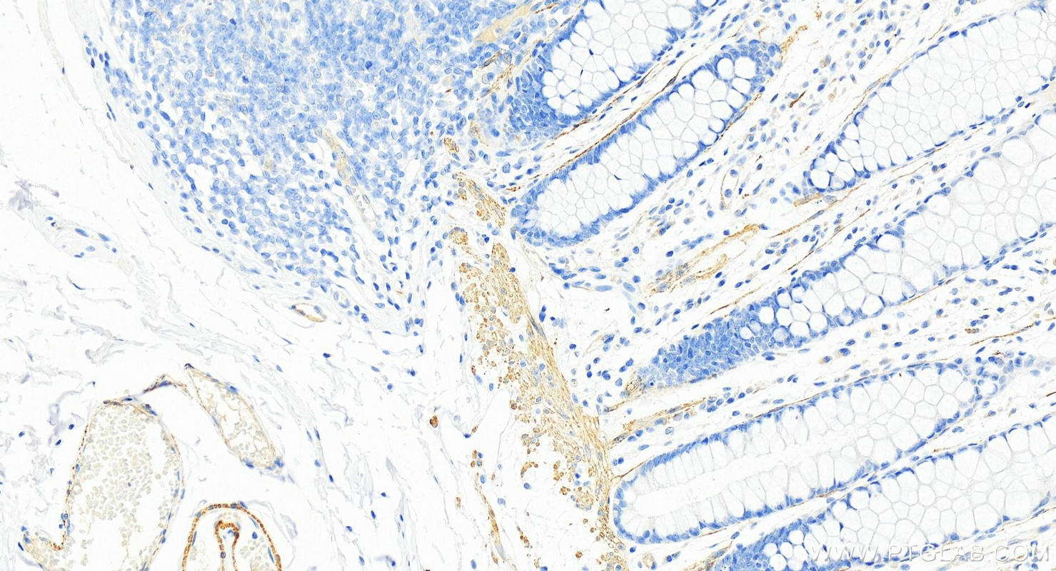 Immunohistochemistry (IHC) staining of human normal colon using SMMHC Polyclonal antibody (18569-1-AP)