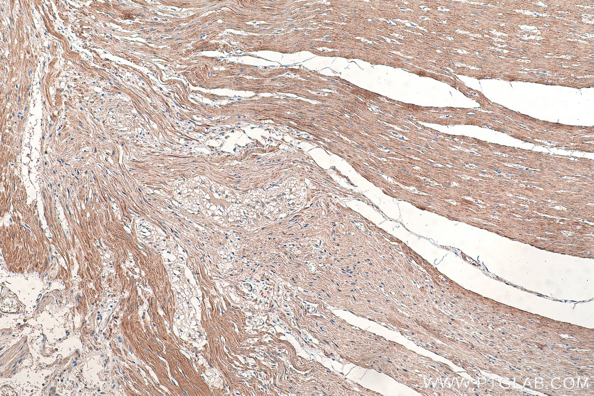 Immunohistochemistry (IHC) staining of human colon tissue using SMMHC Monoclonal antibody (60222-1-Ig)