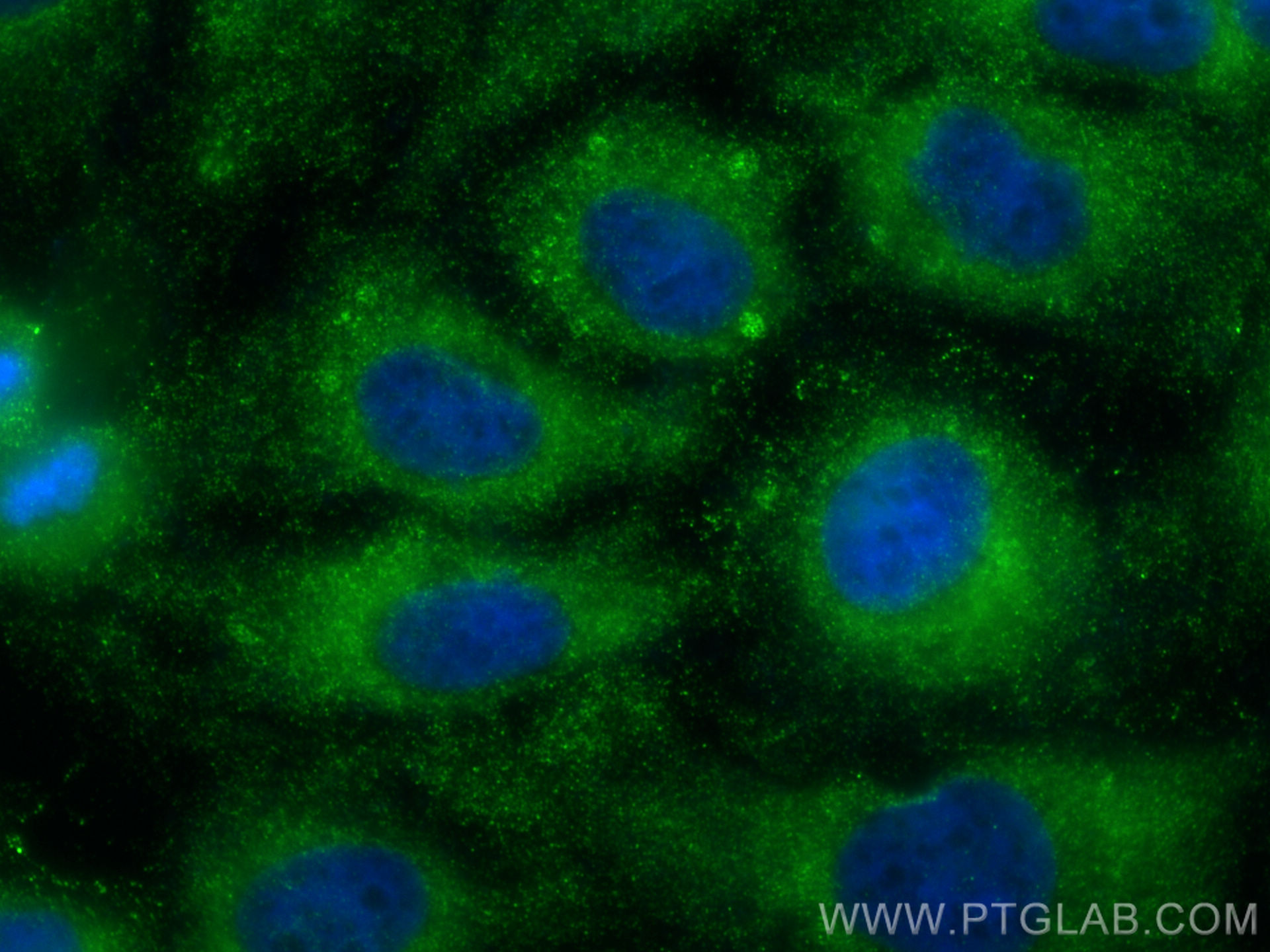 Immunofluorescence (IF) / fluorescent staining of HeLa cells using MYH14 Polyclonal antibody (20716-1-AP)