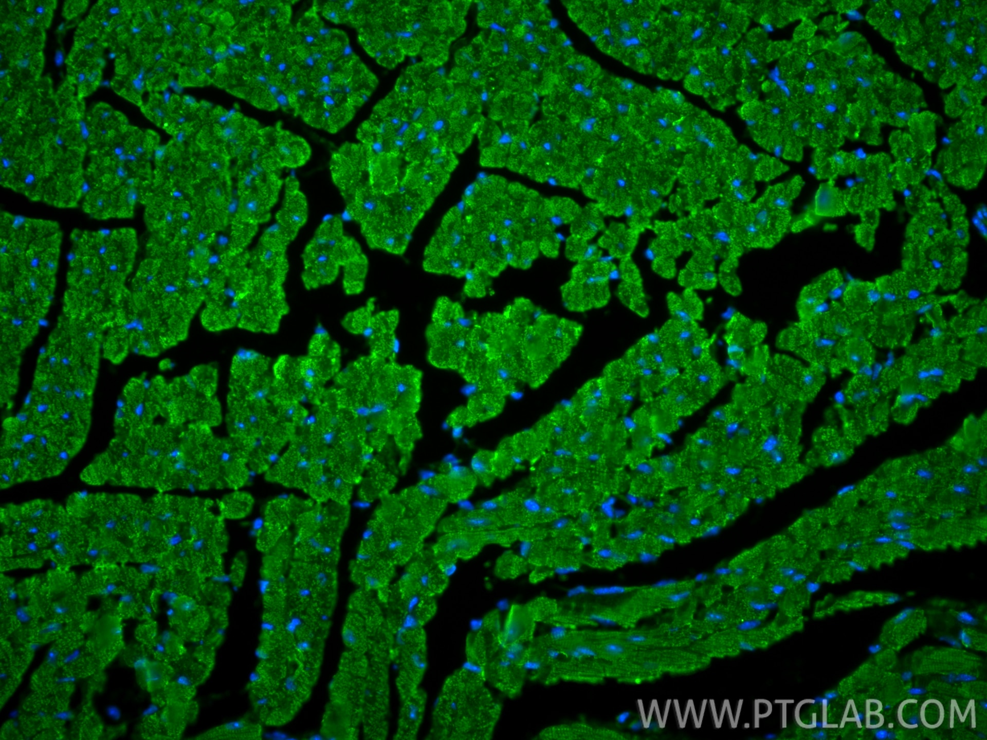 Immunofluorescence (IF) / fluorescent staining of mouse heart tissue using MYH6 Polyclonal antibody (22281-1-AP)