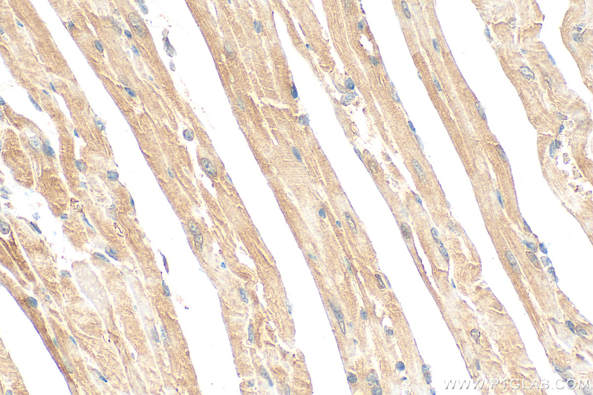 Immunohistochemistry (IHC) staining of mouse heart tissue using MYH7-specific Polyclonal antibody (22280-1-AP)