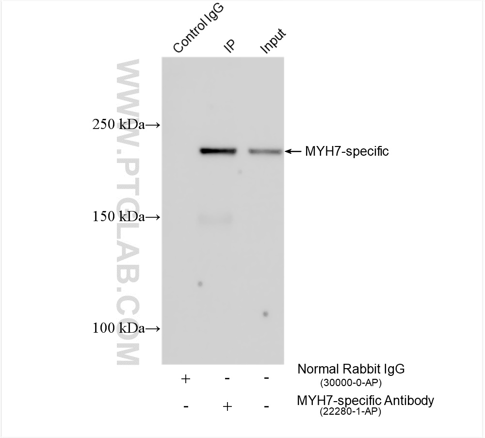 Immunoprecipitation (IP) experiment of mouse heart tissue using MYH7-specific Polyclonal antibody (22280-1-AP)