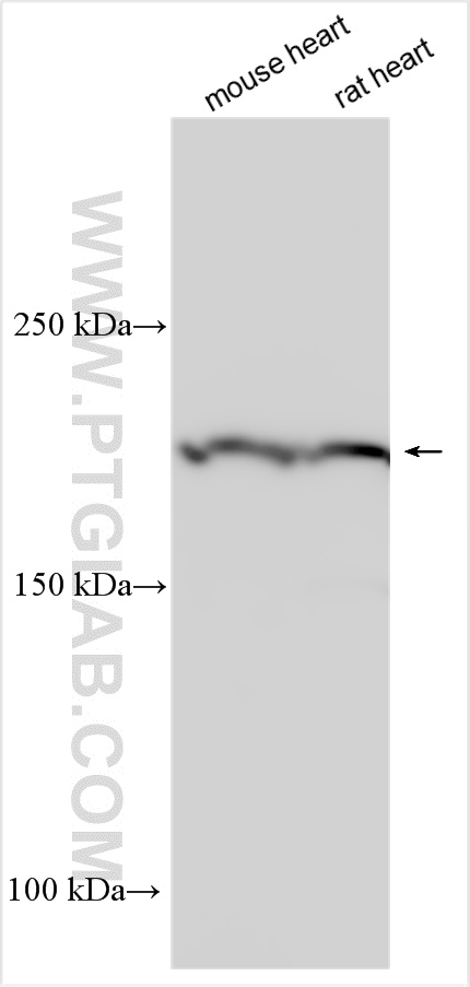 Western Blot (WB) analysis of various lysates using MYH7-specific Polyclonal antibody (22280-1-AP)