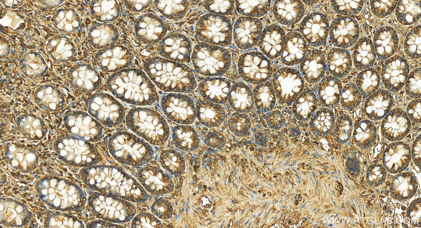 Immunohistochemistry (IHC) staining of human colon tissue using MYH9 Polyclonal antibody (11128-1-AP)