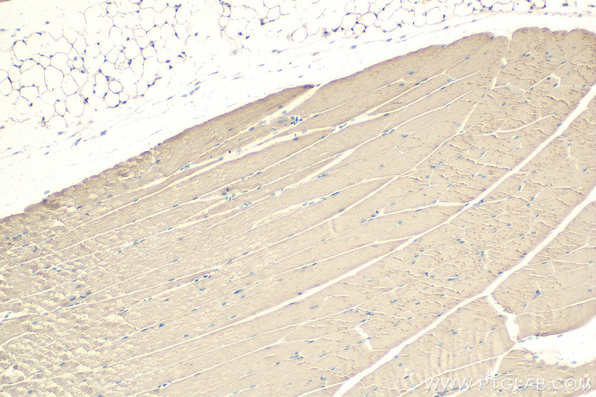 Immunohistochemistry (IHC) staining of mouse skeletal muscle tissue using MYL1 Polyclonal antibody (15814-1-AP)