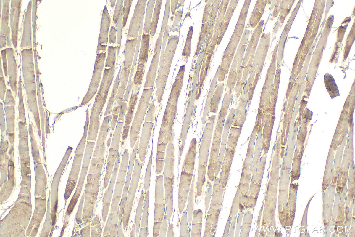 Immunohistochemistry (IHC) staining of rat skeletal muscle tissue using MYL1 Polyclonal antibody (15814-1-AP)