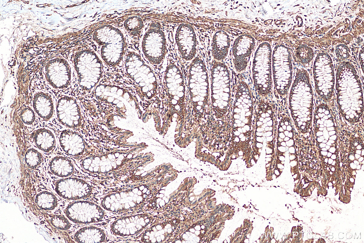 Immunohistochemistry (IHC) staining of human colon tissue using MYL12B Polyclonal antibody (10324-1-AP)