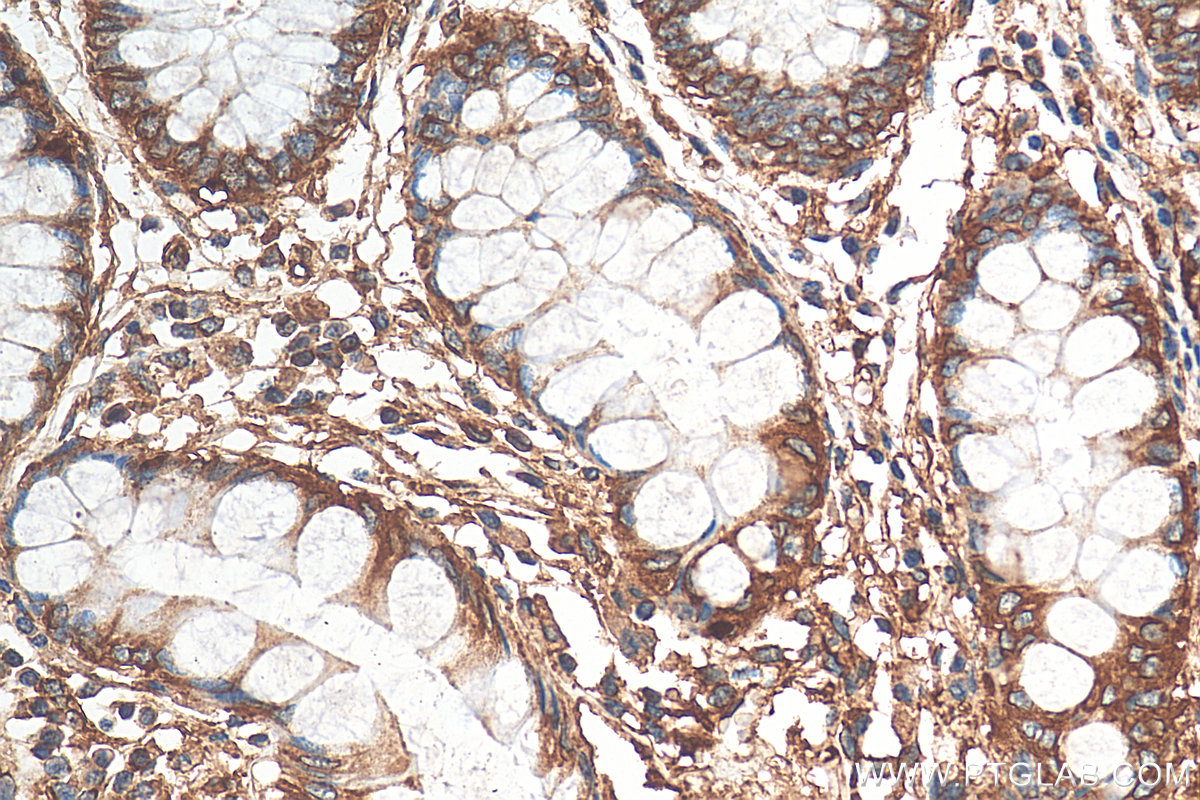 Immunohistochemistry (IHC) staining of human colon tissue using MYL12B Polyclonal antibody (10324-1-AP)