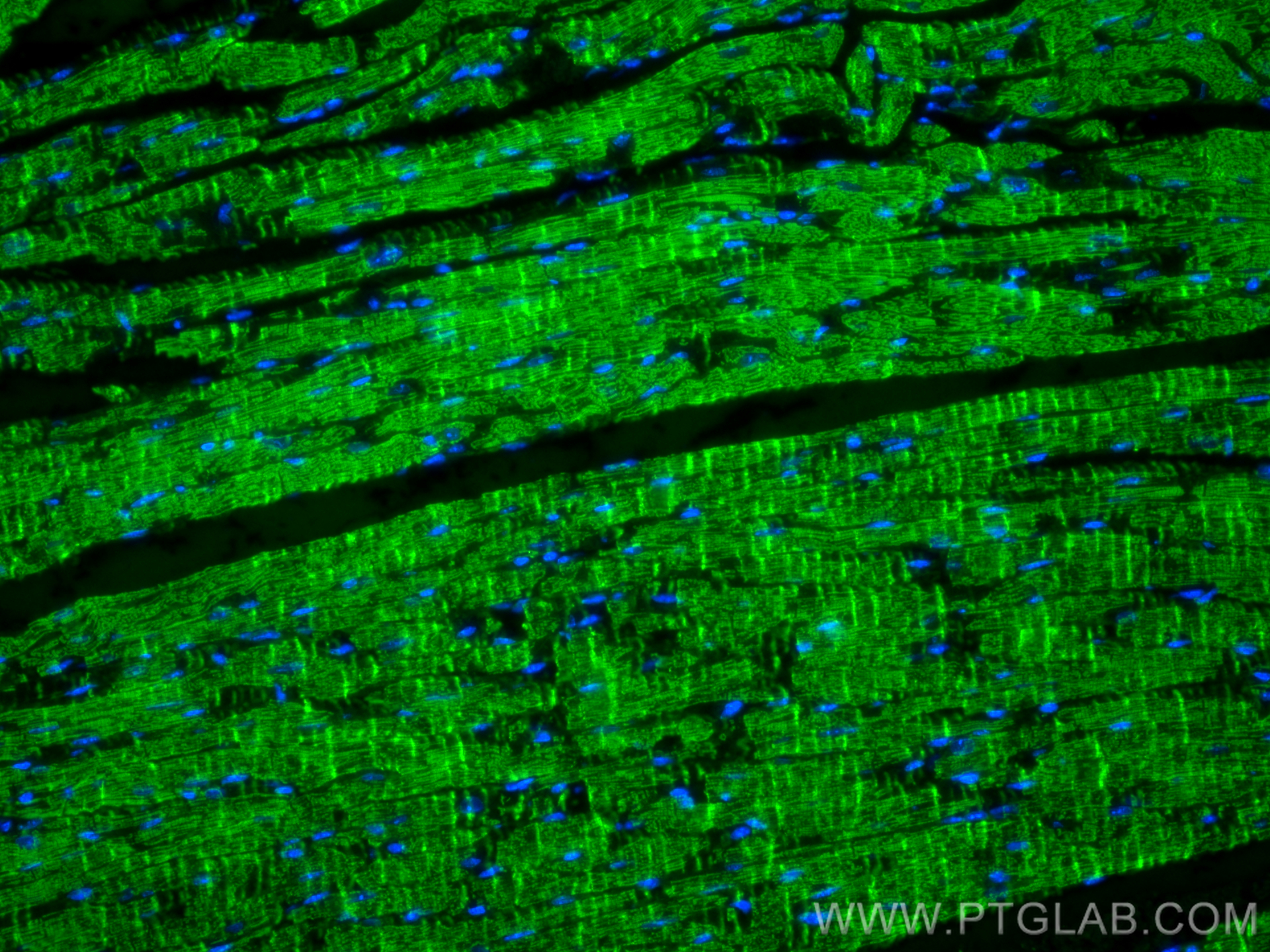 Immunofluorescence (IF) / fluorescent staining of mouse heart tissue using Myosin Light Chain 2/MLC-2V Polyclonal antibody (10906-1-AP)