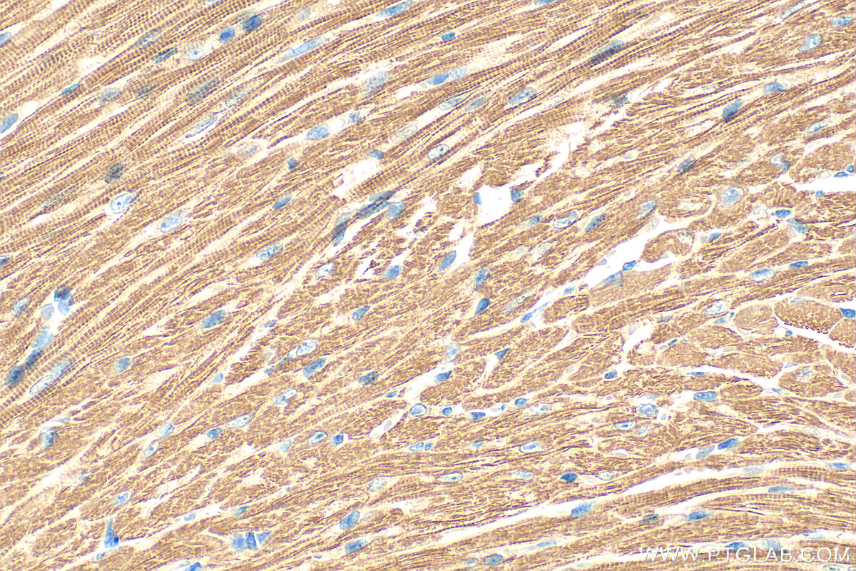 Immunohistochemistry (IHC) staining of mouse heart tissue using Myosin Light Chain 2/MLC-2V Polyclonal antibody (10906-1-AP)