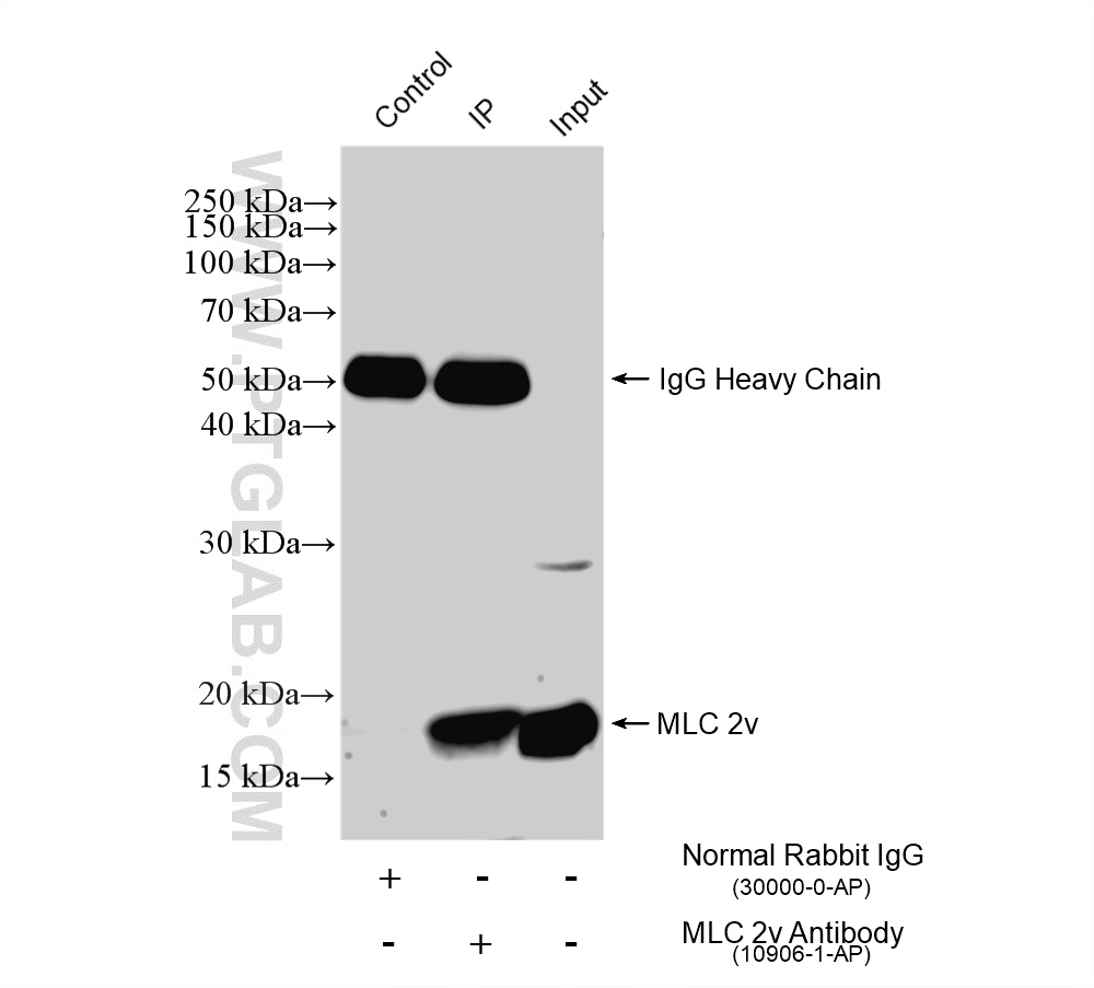 Immunoprecipitation (IP) experiment of mouse heart tissue using Myosin Light Chain 2/MLC-2V Polyclonal antibody (10906-1-AP)