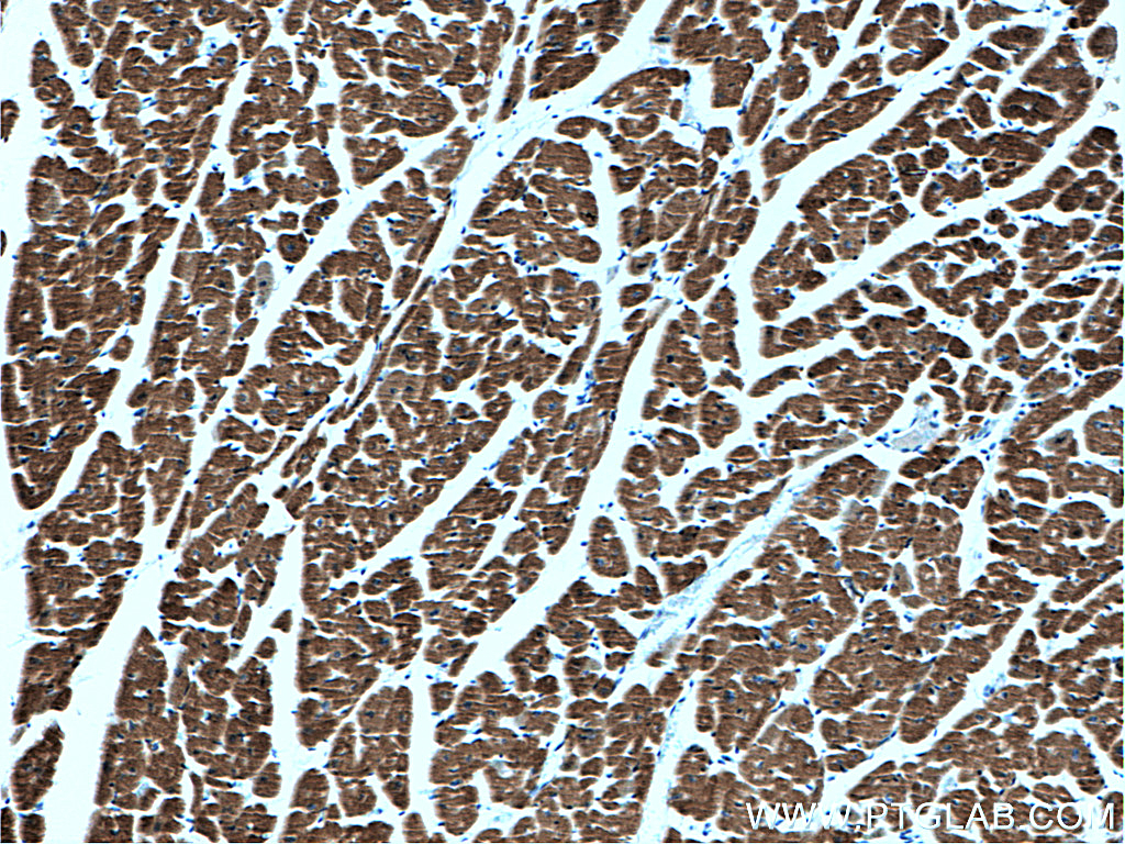 Immunohistochemistry (IHC) staining of human heart tissue using Myosin Light Chain 2/MLC-2V Monoclonal antibody (60229-1-Ig)