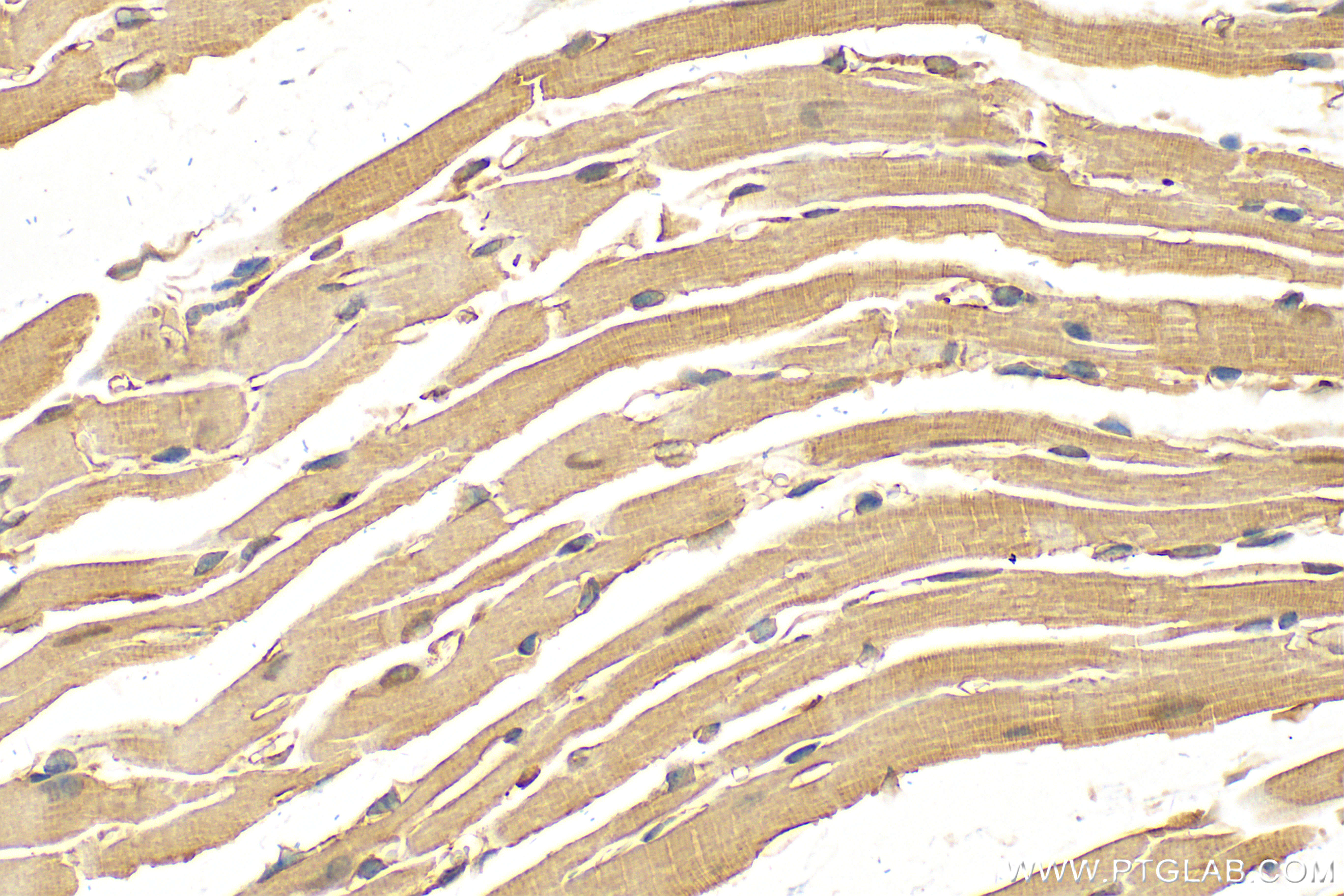 Immunohistochemistry (IHC) staining of mouse heart tissue using MYL6 Polyclonal antibody (18158-1-AP)