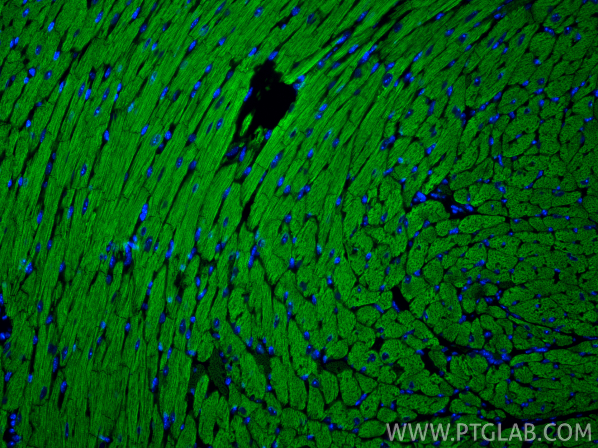 Immunofluorescence (IF) / fluorescent staining of mouse heart tissue using MYL7 Polyclonal antibody (17283-1-AP)