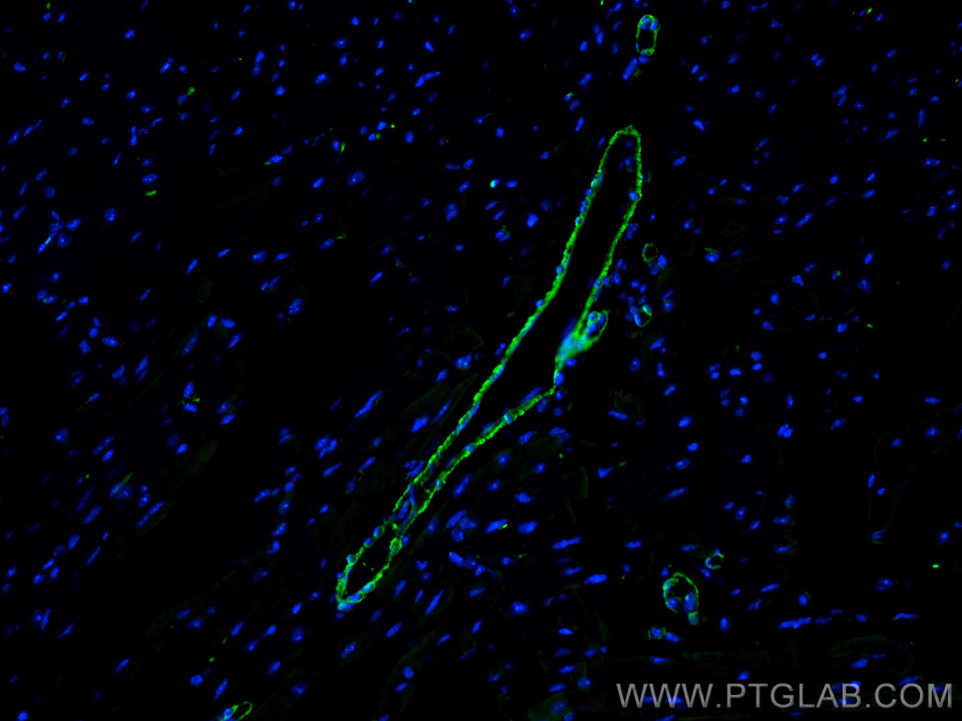 Immunofluorescence (IF) / fluorescent staining of mouse heart tissue using MYL9 Polyclonal antibody (15354-1-AP)