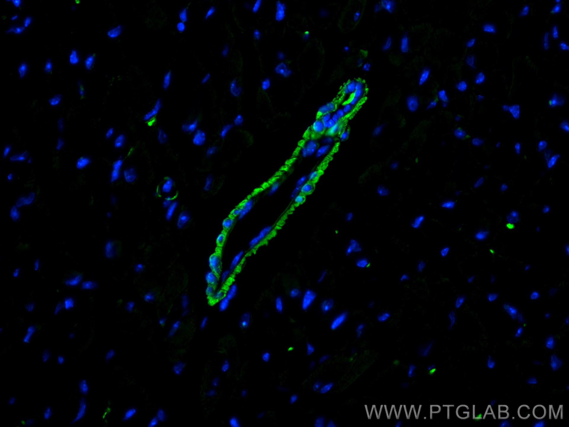 Immunofluorescence (IF) / fluorescent staining of mouse heart tissue using MYL9 Polyclonal antibody (15354-1-AP)