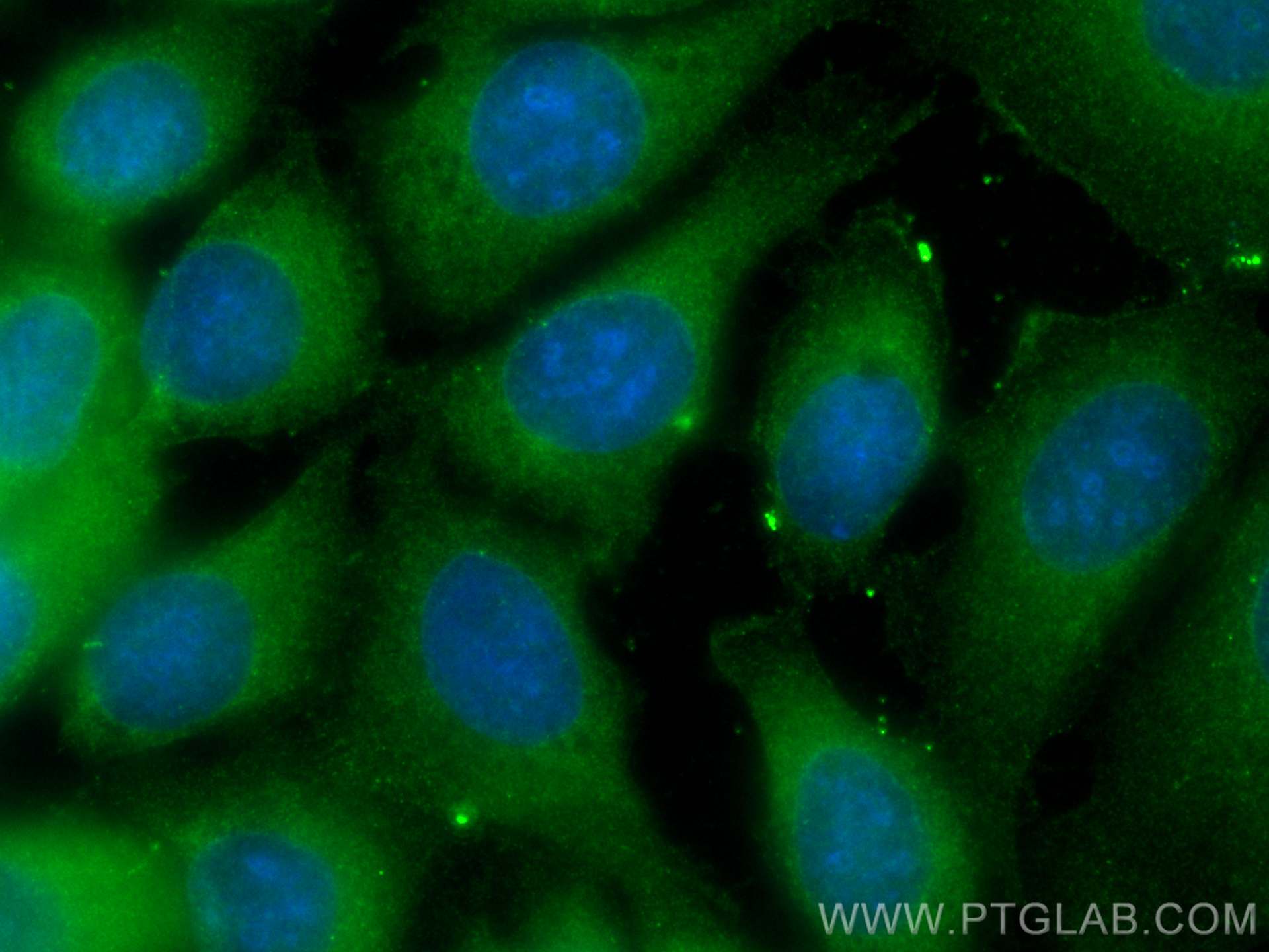 Immunofluorescence (IF) / fluorescent staining of MCF-7 cells using CoraLite® Plus 488-conjugated MYL9 Polyclonal anti (CL488-15354)