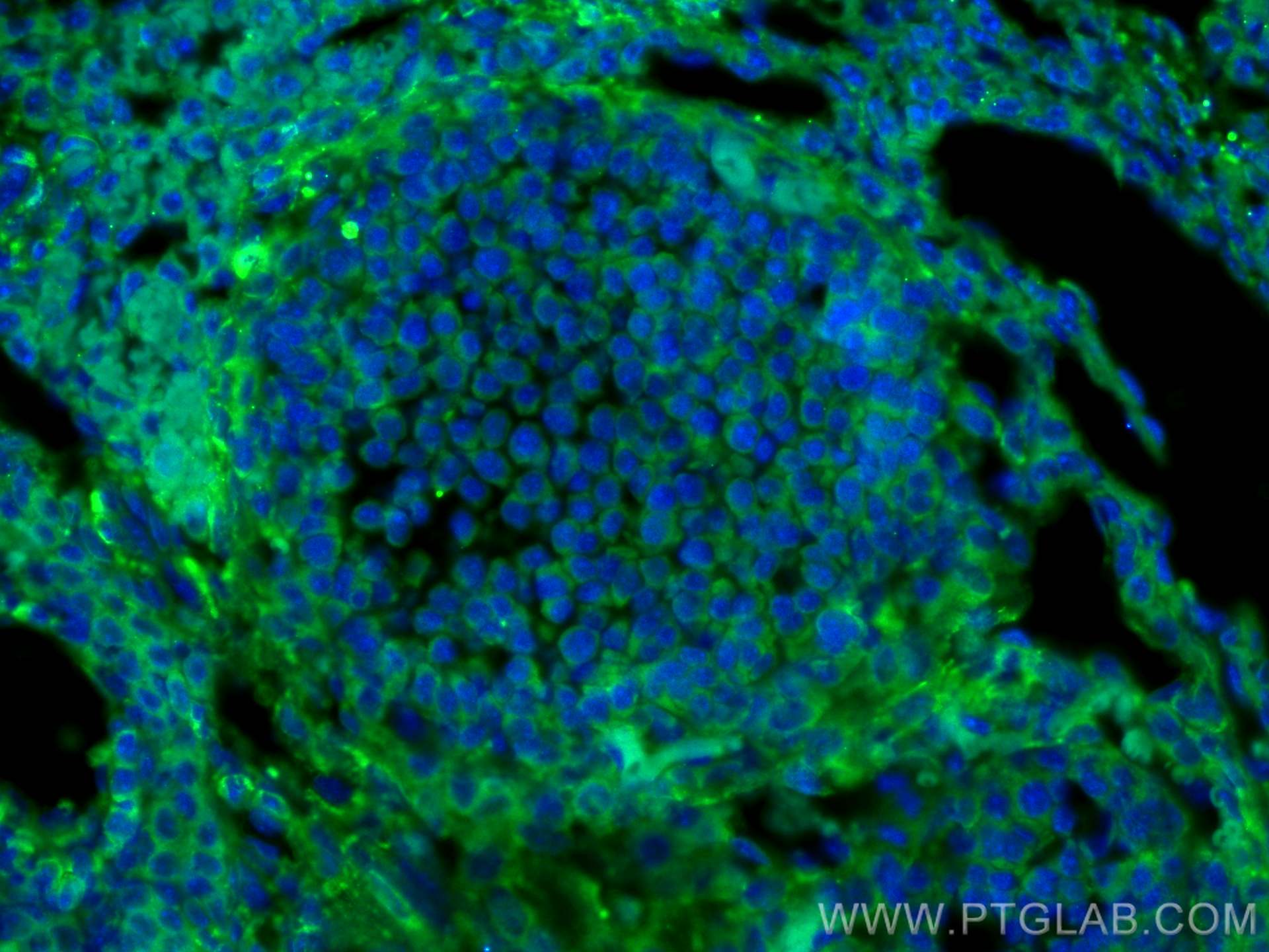 Immunofluorescence (IF) / fluorescent staining of mouse ovary tissue using MYLK Polyclonal antibody (21642-1-AP)