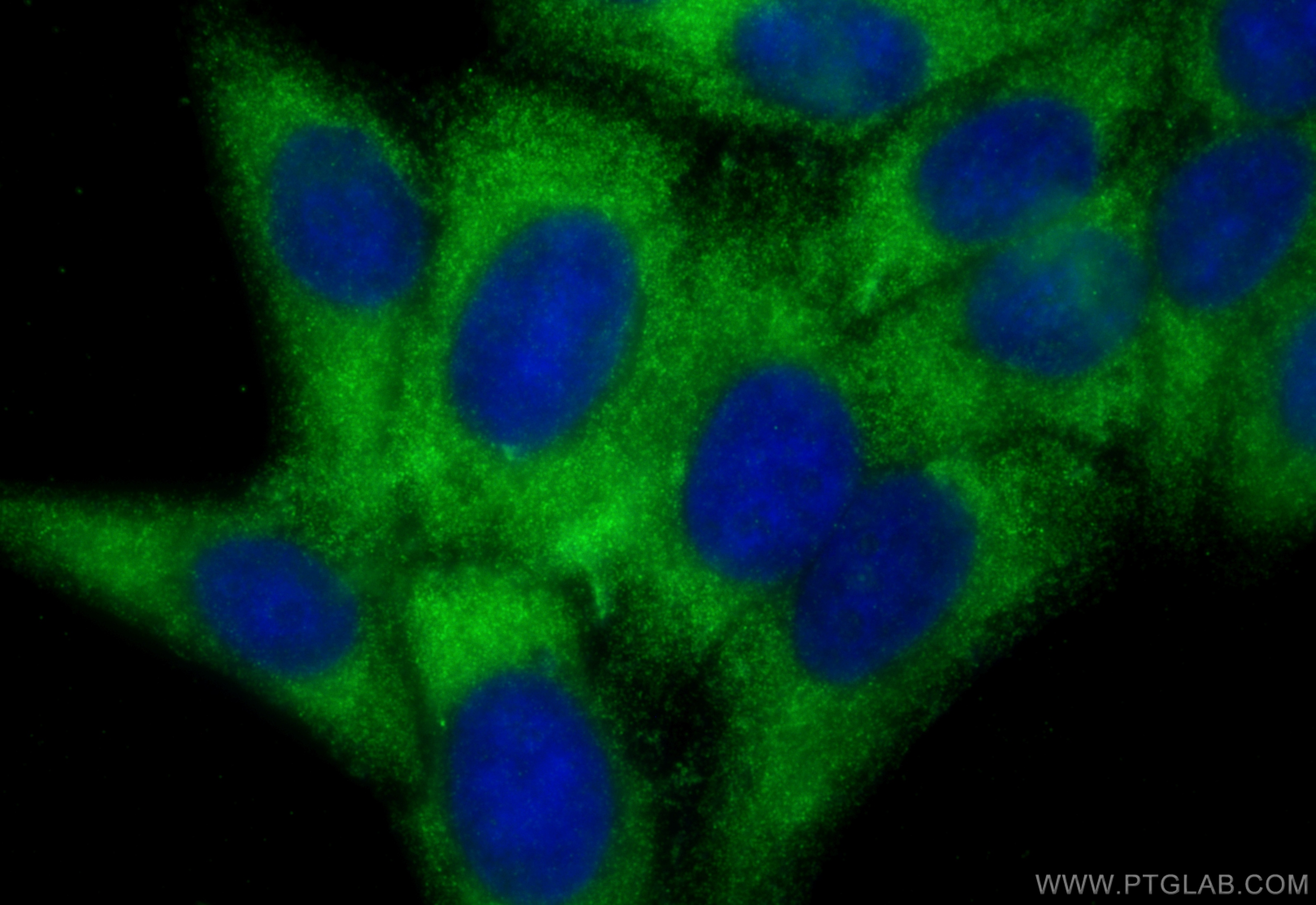 Immunofluorescence (IF) / fluorescent staining of HepG2 cells using MYLK Polyclonal antibody (21642-1-AP)