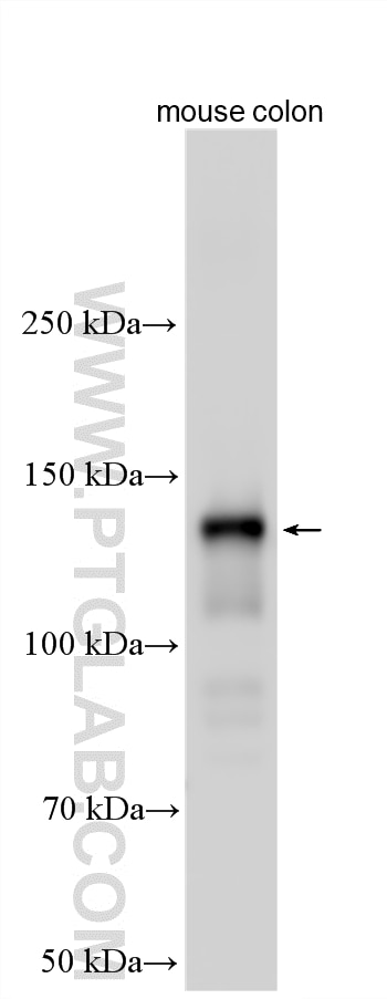 Western Blot (WB) analysis of various lysates using MYLK Polyclonal antibody (21642-1-AP)