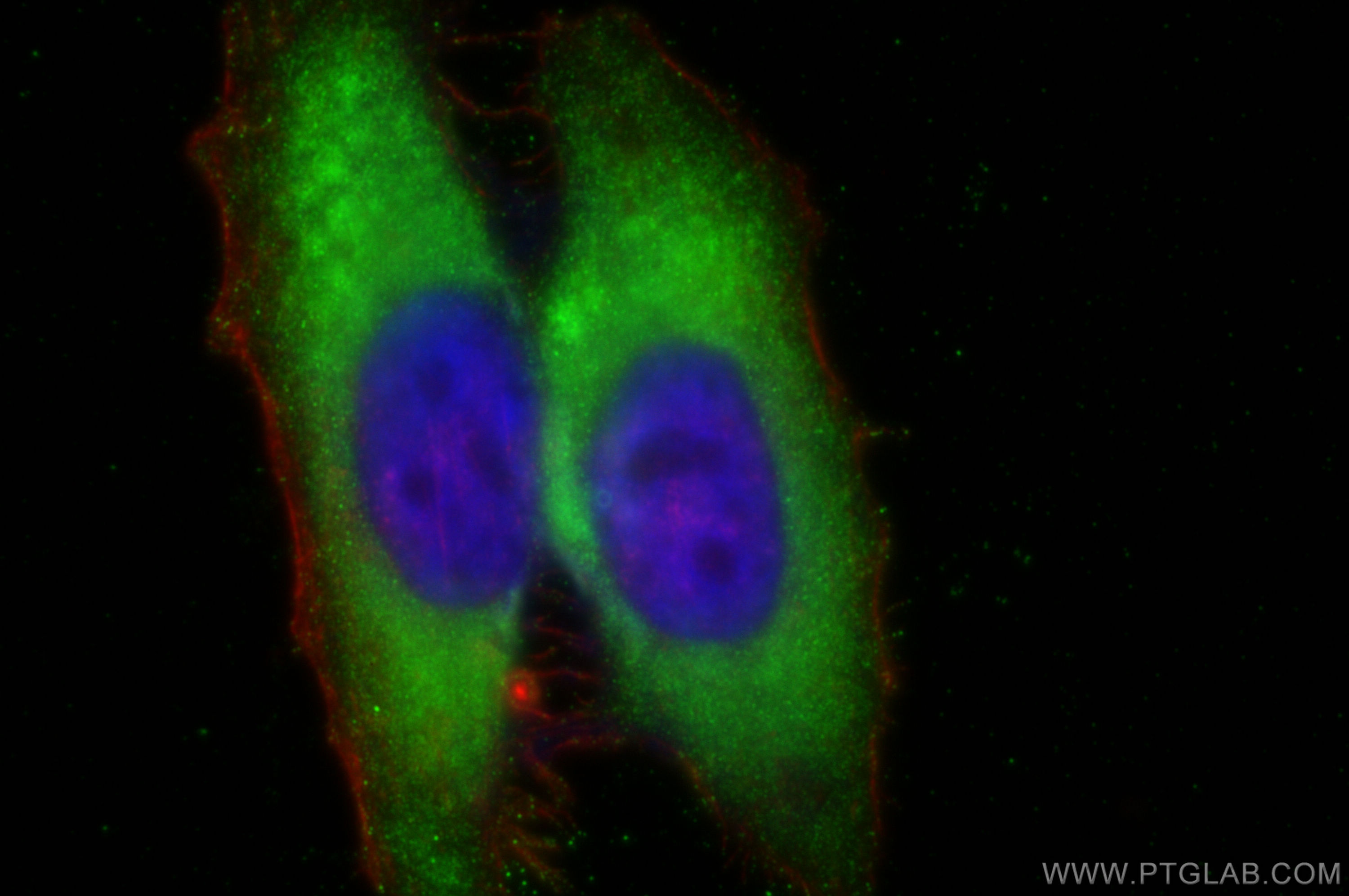 Immunofluorescence (IF) / fluorescent staining of HepG2 cells using MYO1A Polyclonal antibody (17499-1-AP)