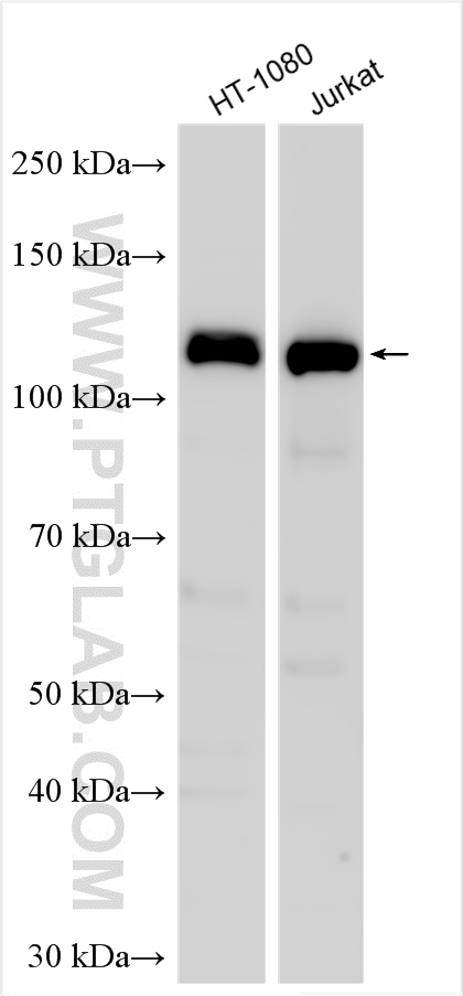 Western Blot (WB) analysis of various lysates using MYO1E Polyclonal antibody (17768-1-AP)
