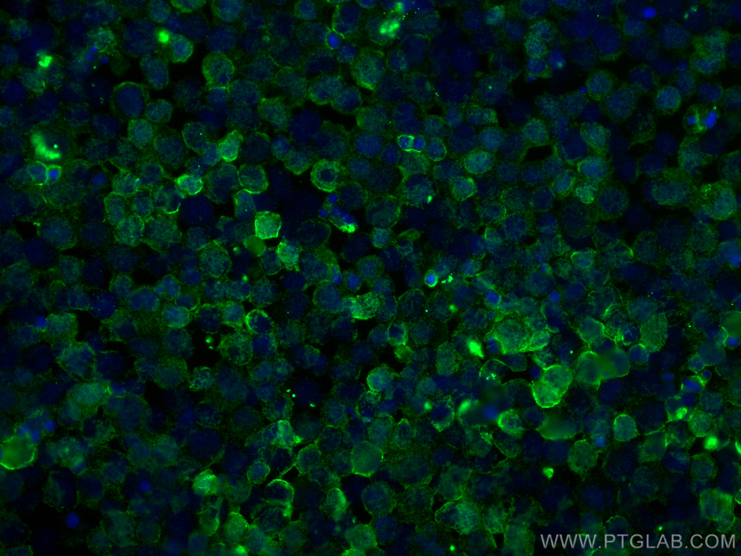 Immunofluorescence (IF) / fluorescent staining of Jurkat cells using MYO1G Polyclonal antibody (25772-1-AP)