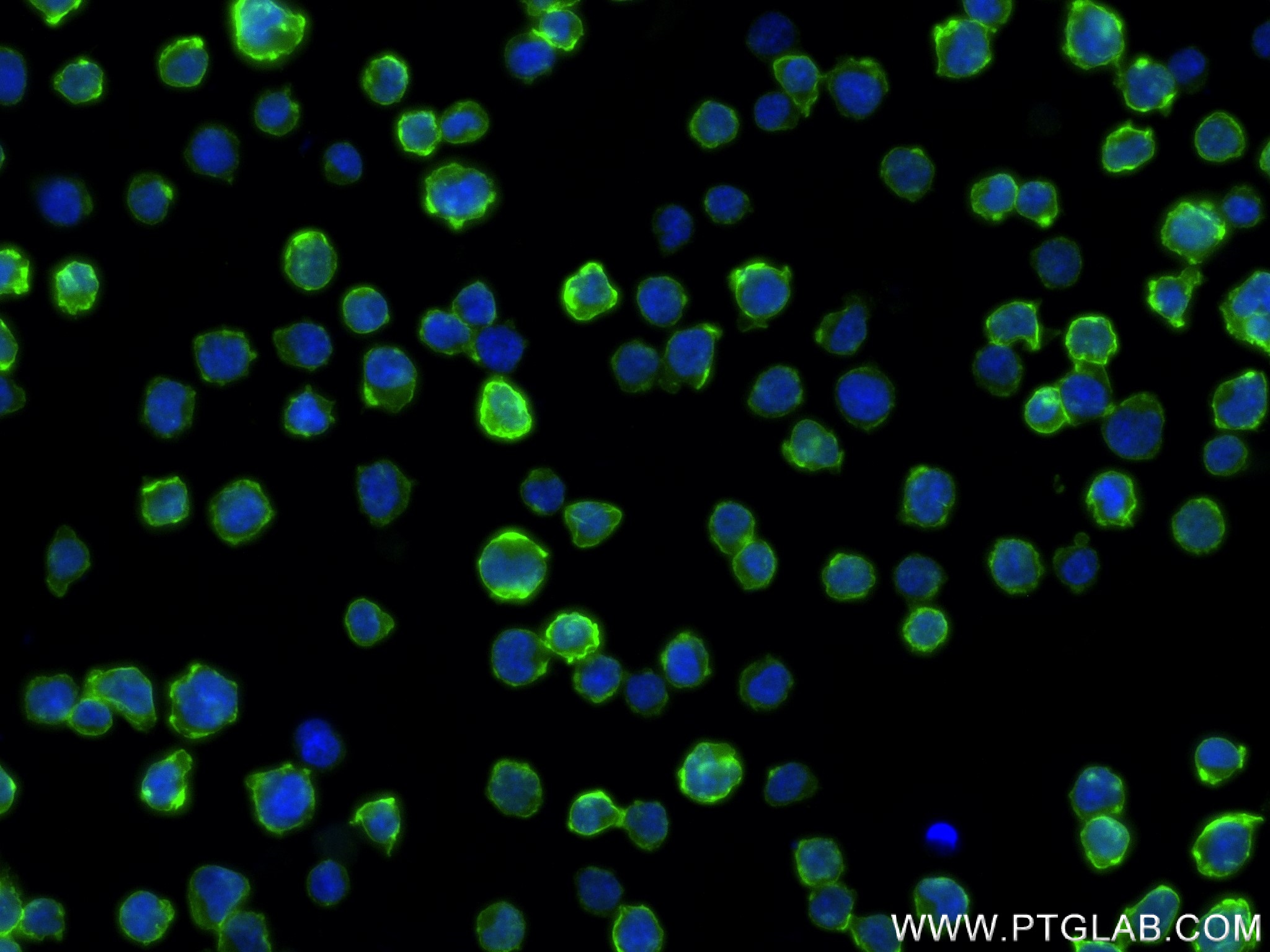 Immunofluorescence (IF) / fluorescent staining of Jurkat cells using MYO1G Recombinant antibody (83556-5-RR)