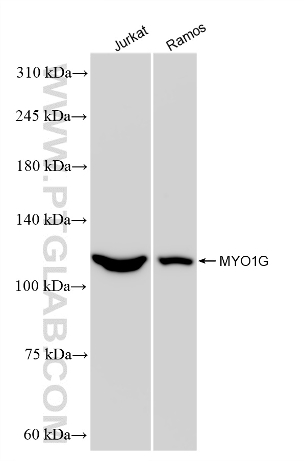 Western Blot (WB) analysis of various lysates using MYO1G Recombinant antibody (83556-5-RR)