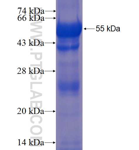 MYO1G fusion protein Ag22698 SDS-PAGE