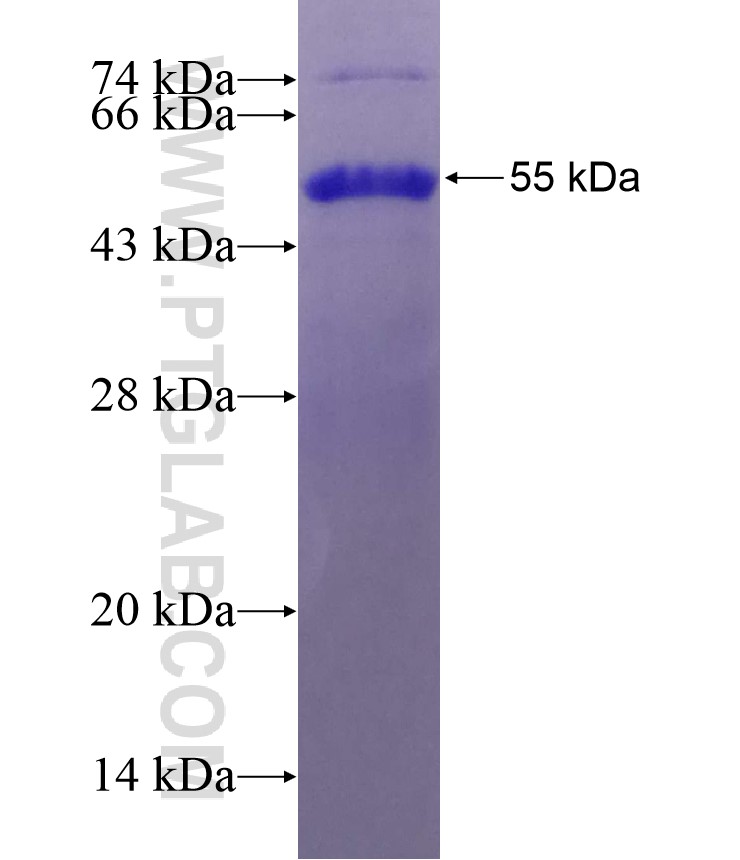 MYO3A fusion protein Ag29335 SDS-PAGE