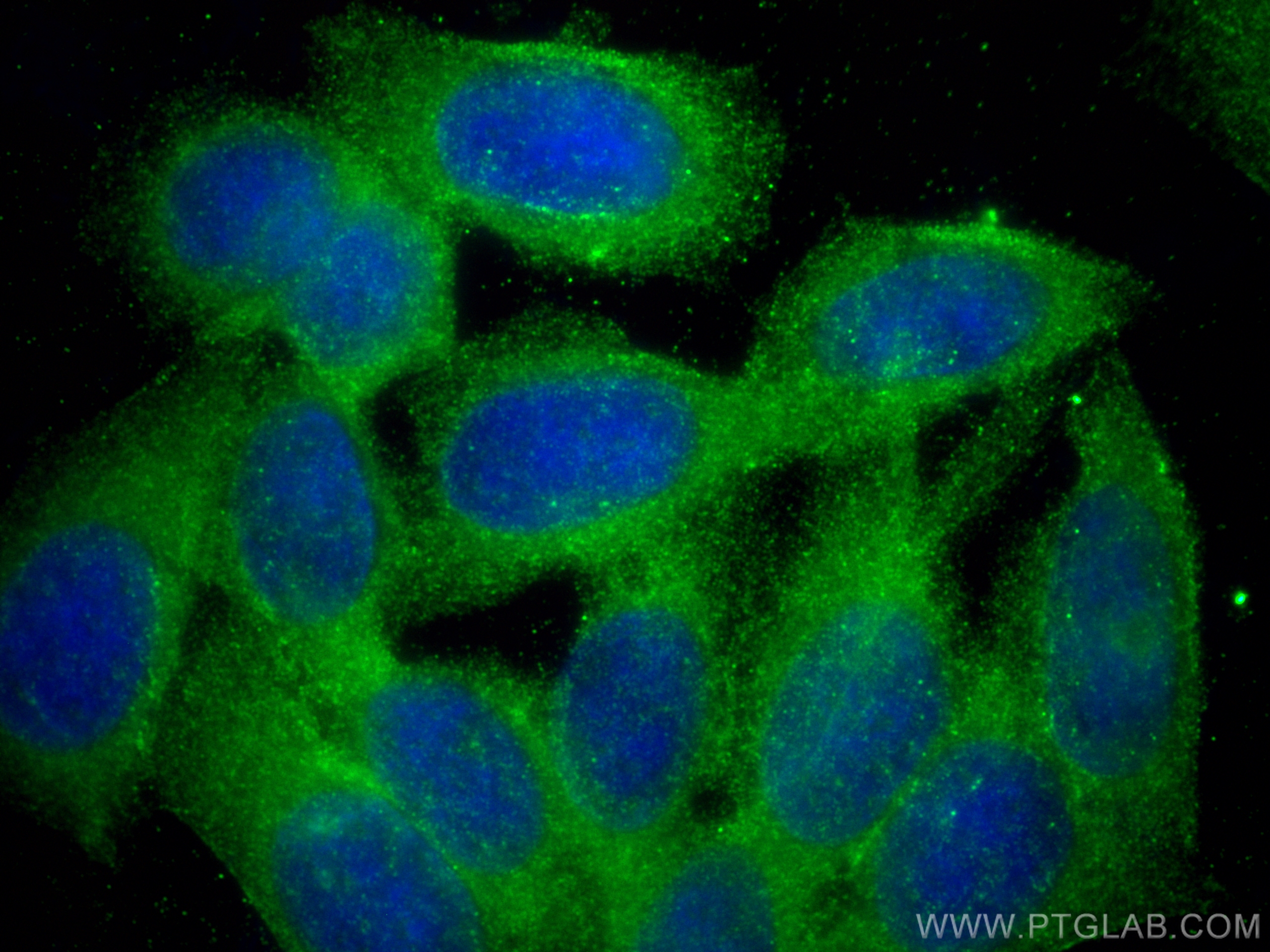 Immunofluorescence (IF) / fluorescent staining of HepG2 cells using MYO7A Polyclonal antibody (20720-1-AP)