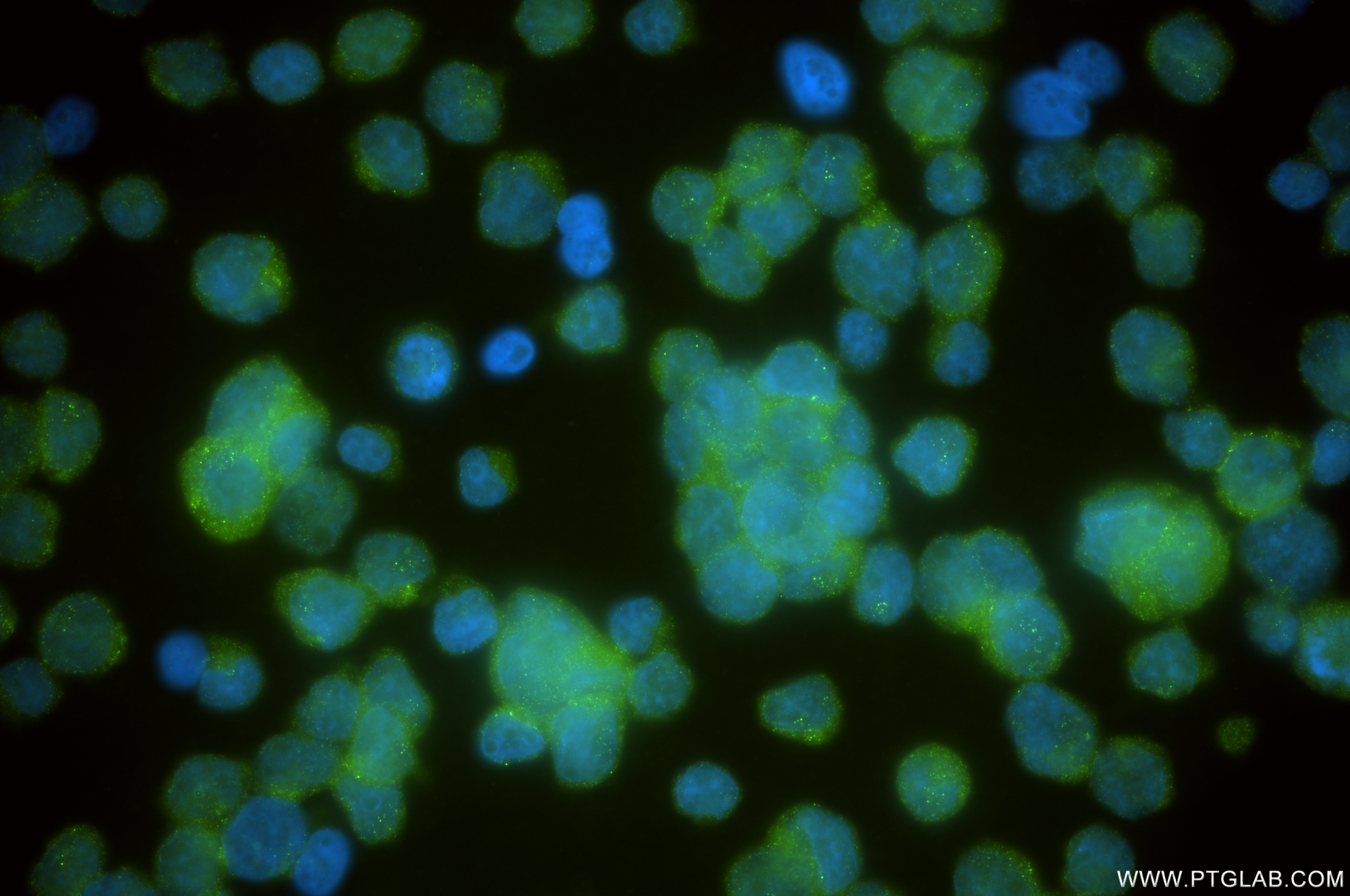 Immunofluorescence (IF) / fluorescent staining of Y79 cells using MYO7A Recombinant antibody (83807-1-RR)