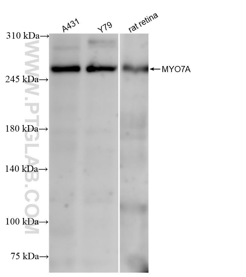 Western Blot (WB) analysis of various lysates using MYO7A Recombinant antibody (83807-1-RR)