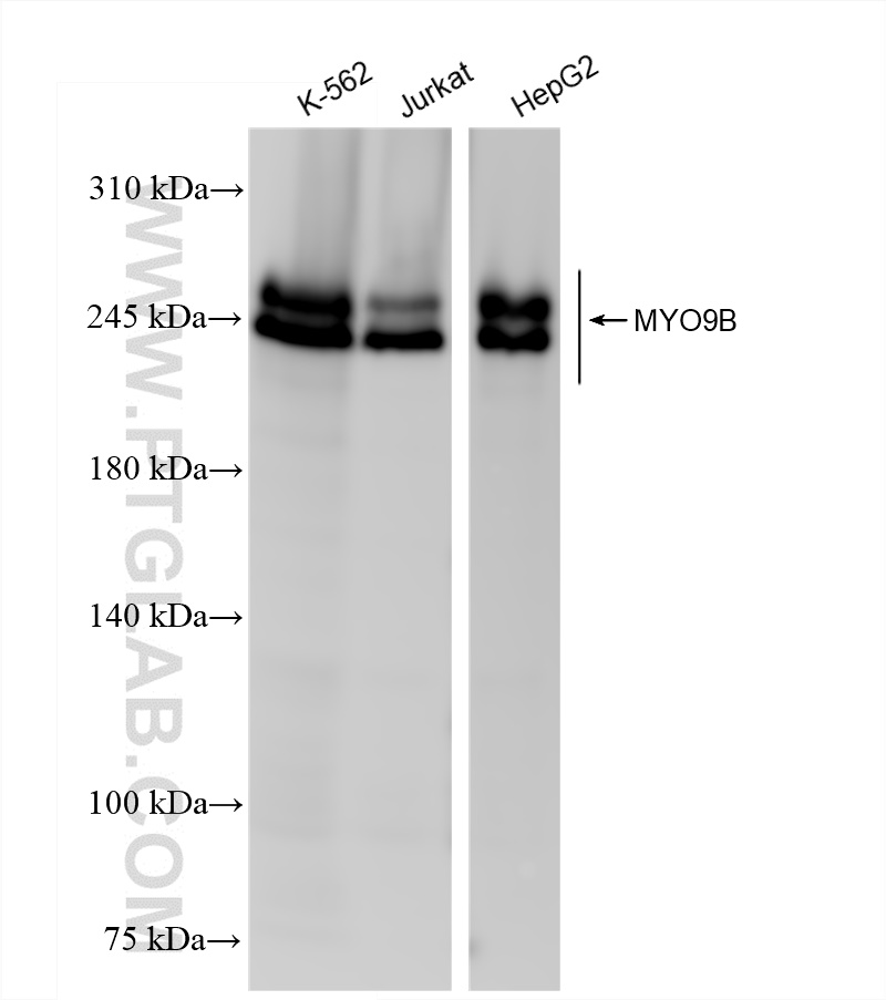 MYO9B